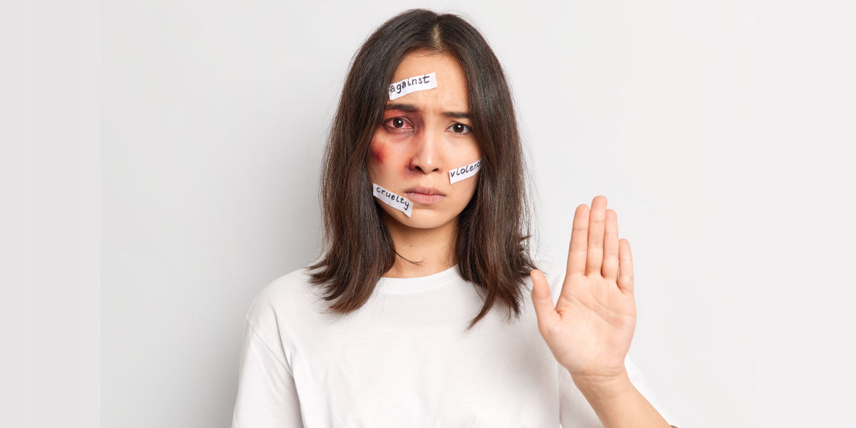 A woman with a bruised eye holding her palm up, with three stickers attached to her face that read "against," "violence," and "cruelty".